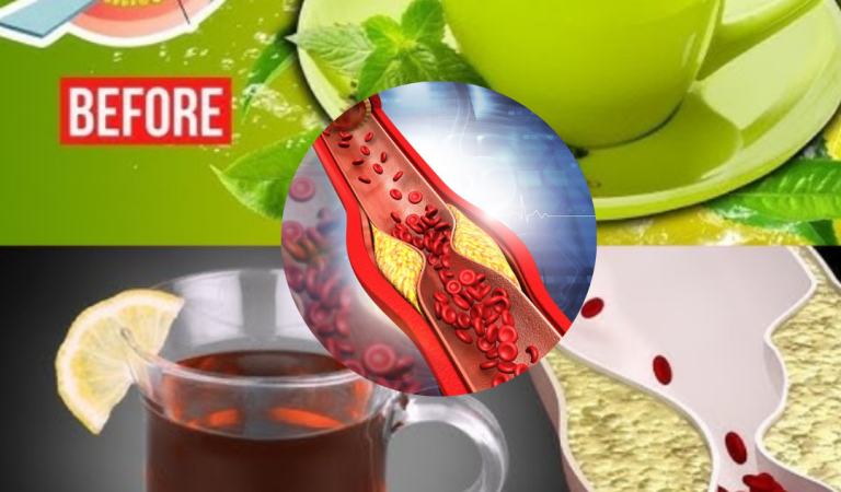 Top 3 Teas to Clear Out Your Arteries Naturally