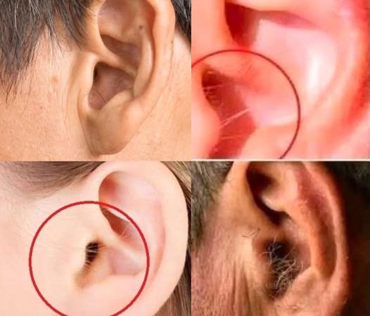 Did you know that if your ear hairs grow, it is because your body is